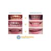 Machouyou Dispositif 1eres dents Prune dés 2 ans – Image 3